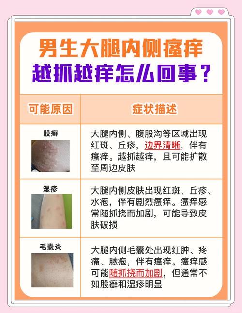 男人大腿内侧敏感怎么办？3步精准护理法摆脱瘙痒两性知识-两性健康-两性心理-两性技巧两性知识丨两性健康--你想了解的我都知道