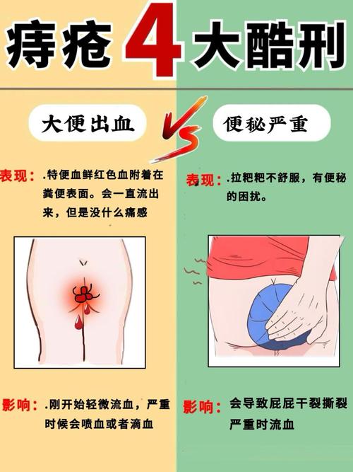 肛门有敏感点吗