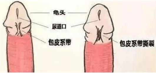 男士最敏感的部位图｜5大敏感区刺激方法与禁忌全解析两性知识-两性健康-两性心理-两性技巧两性知识丨两性健康--你想了解的我都知道