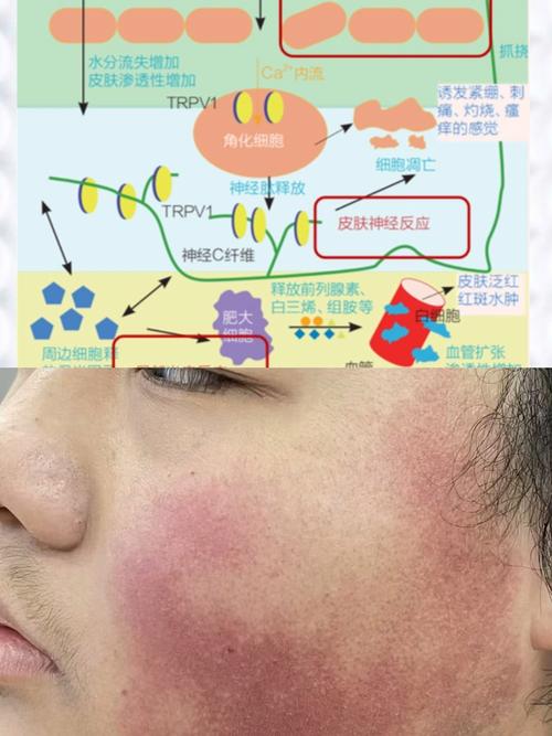 敏感地带反应