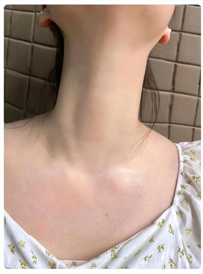 女人脖子敏感用什么护肤品？2025实测推荐清单两性知识-两性健康-两性心理-两性技巧两性知识丨两性健康--你想了解的我都知道
