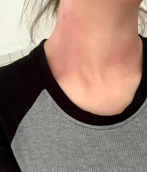 女人脖子敏感