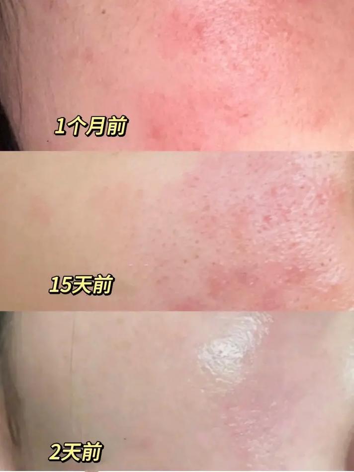 敏感的女孩