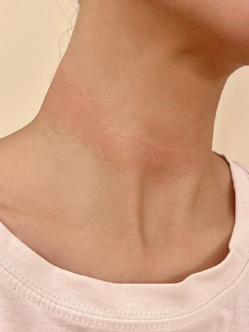 女生脖子敏感