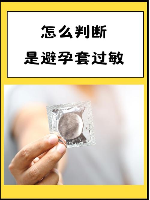 避孕套瘙痒难忍？3步急救法24小时舒缓 - 两性知识丨两性健康-你想了解的我都知道两性知识-两性健康-两性心理-两性技巧两性知识丨两性健康--你想了解的我都知道