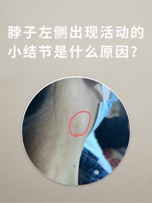 汗多颈后红肿痒？3步护理法告别敏感肌！ - 两性知识丨两性健康-你想了解的我都知道两性知识-两性健康-两性心理-两性技巧两性知识丨两性健康--你想了解的我都知道