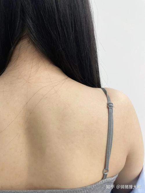 汗后背部刺痒难忍？3步快速止痒法，清爽过夏 - 两性知识丨两性健康-你想了解的我都知道两性知识-两性健康-两性心理-两性技巧两性知识丨两性健康--你想了解的我都知道