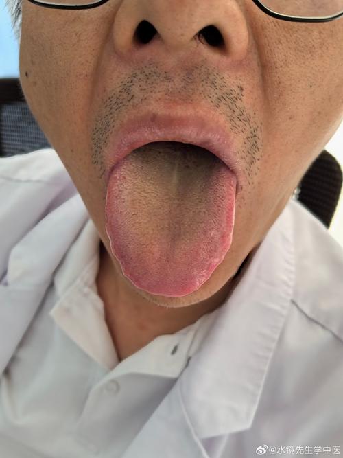 舌头变敏感不敢吃辣？3步缓解+饮食清单实测有效 - 两性知识丨两性健康-你想了解的我都知道两性知识-两性健康-两性心理-两性技巧两性知识丨两性健康--你想了解的我都知道