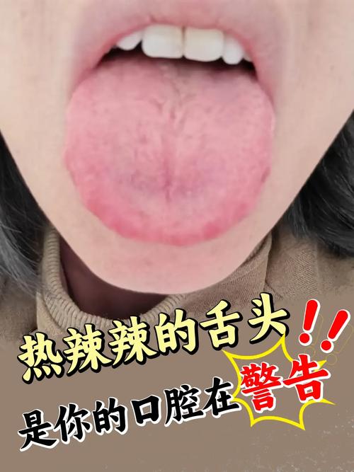 舌头变敏感